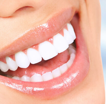 5 Natural Teeth Whitening Home Remedies