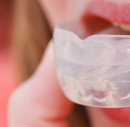 Can You Wear Any Types Of Dental Mouth Guards?
