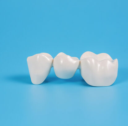 When is a Dental Crown Needed?