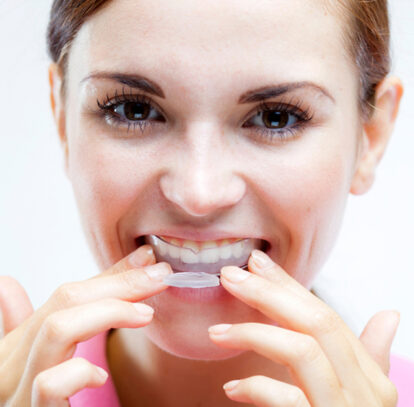 Types and Uses of Mouthguards