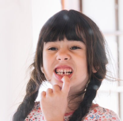 Cute little showing her missing teeth, to be treated with dental bridges in Oshawa, ON.