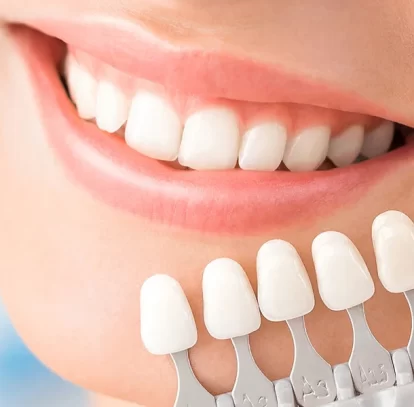 Why Veneers May Be the Perfect Solution for Your Chipped Teeth